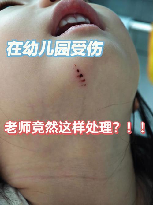 早教中心幼儿伤害案例